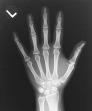 X-ray hand.jpg