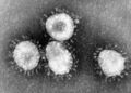 Coronaviruses.jpg